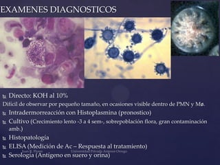 EXAMENES DIAGNOSTICOS



Directo: KOH al 10%

Difícil de observar por pequeño tamaño, en ocasiones visible dentro de PMN y Mø.







Intradermorreacción con Histoplasmina (pronostico)
Cultivo (Crecimiento lento -3 a 4 sem-, sobrepoblación flora, gran contaminación
amb.)
Histopatología
ELISA (Medición de Ac – Respuesta al tratamiento)
Serología (Antígeno en suero y orina)

 