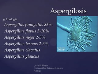 Aspergilosis


Etiología

Aspergillus fumigatus 85%
Aspergillus flavus 5-10%
Aspergillus niger 2-3%
Aspergillus terreus 2-3%
Aspergillus clavatus
Aspergillus glaucus

 