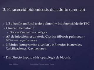 3. Paracoccidioidomicosis del adulto (crónico)





1/3 afección unifocal (solo pulmón) = Indiferenciable de TBC
Clínica tuberculoide








Disociación clínico-radiológica

AP de infección respiratoria Crónica (fibrosis pulmonar 60%- → cor-pulmonale)
Nódulos (compromiso alveolar), infiltrados bilaterales,
Calcificaciones, Cavitaciones.
Dx: Directo Esputo e histopatología de biopsia.

 