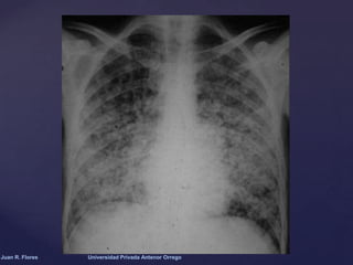 Juan R. Flores

Universidad Privada Antenor Orrego

 