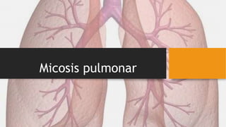 Micosis pulmonar
 
