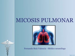 MICOSIS PULMONAR
Fernando Ruiz Valencia –Médico neumólogo
 