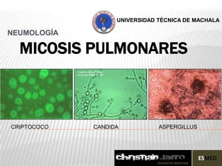 UNIVERSIDAD TÉCNICA DE MACHALA

NEUMOLOGÍA

  MICOSIS PULMONARES



CRIPTOCOCO   CANDIDA           ASPERGILLUS
 
