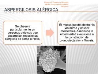 Rippon JW. Tratado de Micología
                               Médica, Hongos y Actinomicetos
                                                    patógenos

ASPERGILOSIS ALÉRGICA

                                                  El mucus puede obstruir la
        Se observa
                                                      vía aérea y causar
    particularmente en
                                                   atelectasia. A menudo la
  personas atópicas que
                                                  enfermedad evoluciona a
  desarrollan reacciones
                                                       la constitución de
alérgicas de asma o rinitis.
                                                  bronquiectasias y fibrosis.
 