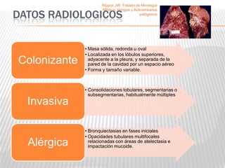 Rippon JW. Tratado de Micología


DATOS RADIOLOGICOS
                      Médica, Hongos y Actinomicetos
                                           patógenos




              • Masa sólida, redonda u oval
              • Localizada en los lóbulos superiores,
Colonizante     adyacente a la pleura, y separada de la
                pared de la cavidad por un espacio aéreo
              • Forma y tamaño variable.



              • Consolidaciones lobulares, segmentarias o
                subsegmentarias, habitualmente múltiples
  Invasiva

              • Bronquiectasias en fases iniciales
              • Opacidades tubulares multifocales
  Alérgica      relacionadas con áreas de atelectasia e
                impactación mucoide.
 