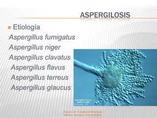 ASPERGILOSIS
Etiología
Aspergillus fumigatus
Aspergillus niger
Aspergillus clavatus
Aspergillus flavus
Aspergillus terreus
Aspergillus glaucus


                 Rippon JW. Tratado de Micología
                 Médica, Hongos y Actinomicetos
 