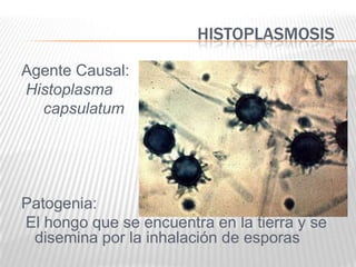 HISTOPLASMOSIS

Agente Causal:
Histoplasma
  capsulatum




Patogenia:
El hongo que se encuentra en la tierra y se
 disemina por la inhalación de esporas
 