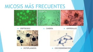 MICOSIS MÁS FRECUENTES
 CRIPTOCOCO  CANDIDA  ASPERGILLUS
 HISTOPLASMOSIS  COCCIDIOIDOMICOSIS
 