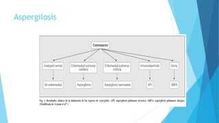 Aspergilosis
 