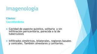 Imagenología
Clásico:
Coccidioidoma
 Cavidad de aspecto quístico, solitaria y sin
infiltración pericavitaria, parecida a la de
tuberculosis
 Infiltrados simétricos, bilaterales, regiones basales
y centrales. También alveolares y cavitarios.
 