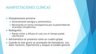MANIFESTACIONES CLÍNICAS
 Histoplasmosis primaria
 Generalmente benigna y asintomática
 Reconocida en forma retrospectiva por la positividad de
la prueba intradérmica
 Radiografía
 Patrón miliar y difusos el cual con el tiempo puede
calcificarse
 Asintomático se presenta como un cuadro gripal
 Cuando es mas grave se acompaña de hemoptisis, tos,
dolor torácico, hipertermia y ataque al estado general
 