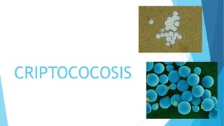 CRIPTOCOCOSIS
 
