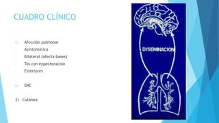 CUADRO CLÍNICO
1) Afección pulmonar
- Asintomática
- Bilateral (afecta bases)
- Tos con expectoración
- Estertores
2) SNC
3) Cutánea
 