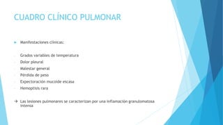 CUADRO CLÍNICO PULMONAR
 Manifestaciones clínicas:
- Grados variables de temperatura
- Dolor pleural
- Malestar general
- Pérdida de peso
- Expectoración mucoide escasa
- Hemoptisis rara
 Las lesiones pulmonares se caracterizan por una inflamación granulomatosa
intensa
 