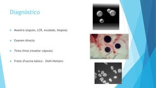 Diagnóstico
 Muestra (esputo, LCR, exudado, biopsia)
 Examen directo
 Tinta china (resaltar cápsula)
 Frotis (Fuscina básica – Ziehl Nielsen)
 