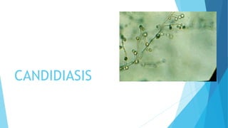 CANDIDIASIS
 