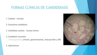 FORMAS CLÍNICAS DE CANDIDDIASIS
1. Cutáneo – mucosas
2. Granuloma candidósico
3. Candidiasis cutáneo – mucosa crónica
4. Candidiasis viscerales
- Broncopulmonar, urinaria, gastrointestinal, vesícula biliar y SNC
5. Septicémicas
 