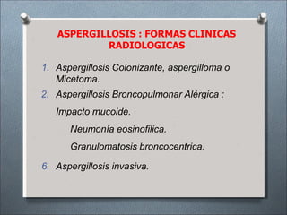 ASPERGILLOSIS : FORMAS CLINICAS
RADIOLOGICAS
1. Aspergillosis Colonizante, aspergilloma o
Micetoma.
2. Aspergillosis Broncopulmonar Alérgica :
Impacto mucoide.
Neumonía eosinofilica.
Granulomatosis broncocentrica.
6. Aspergillosis invasiva.
 