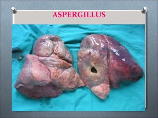 ASPERGILLUS
 