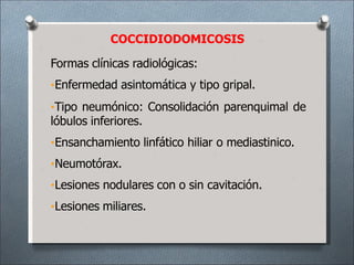 Formas clínicas radiológicas:
•Enfermedad asintomática y tipo gripal.
•Tipo neumónico: Consolidación parenquimal de
lóbulos inferiores.
•Ensanchamiento linfático hiliar o mediastinico.
•Neumotórax.
•Lesiones nodulares con o sin cavitación.
•Lesiones miliares.
COCCIDIODOMICOSIS
 