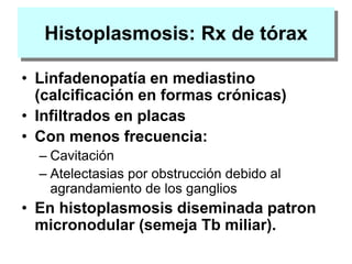 Histoplasmosis: Rx de tórax
• Linfadenopatía en mediastino
(calcificación en formas crónicas)
• Infiltrados en placas
• Con menos frecuencia:
– Cavitación
– Atelectasias por obstrucción debido al
agrandamiento de los ganglios
• En histoplasmosis diseminada patron
micronodular (semeja Tb miliar).
 