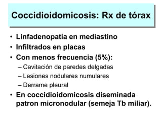 Coccidioidomicosis: Rx de tórax
• Linfadenopatía en mediastino
• Infiltrados en placas
• Con menos frecuencia (5%):
– Cavitación de paredes delgadas
– Lesiones nodulares numulares
– Derrame pleural
• En coccidioidomicosis diseminada
patron micronodular (semeja Tb miliar).
 