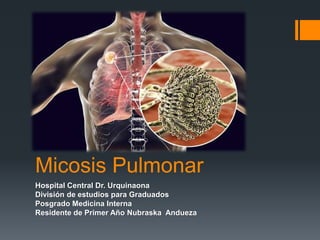 Micosis Pulmonar
Hospital Central Dr. Urquinaona
División de estudios para Graduados
Posgrado Medicina Interna
Residente de Primer Año Nubraska Andueza
 