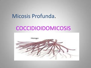Micosis Profunda.

COCCIDIOIDOMICOSIS

 