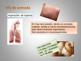 Aspiración de esporas
En muy rara ocasión dando un complejo
cutáneo similar a l de la coccidioidomicosis
pero tiene involución espontanea.
Solo persiste en inmunosuprimidos.

 