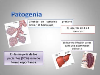 Creando un complejo
similar al tuberuloso

primario
RI aparece de 3 a 4
semanas.

En la primo infección puede
darse una diseminación
silenciosa.

En la mayoría de los
pacientes (95%) sana de
forma espontanea

 
