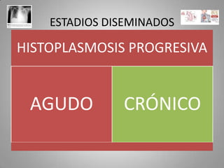ESTADIOS DISEMINADOS

HISTOPLASMOSIS PROGRESIVA

AGUDO

CRÓNICO

 