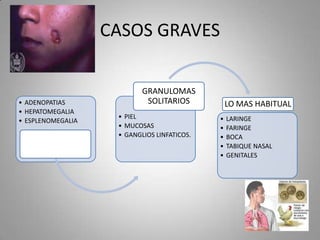 CASOS GRAVES

• ADENOPATIAS
• HEPATOMEGALIA
• ESPLENOMEGALIA

GRANULOMAS
SOLITARIOS
• PIEL
• MUCOSAS
• GANGLIOS LINFATICOS.

LO MAS HABITUAL
•
•
•
•
•

LARINGE
FARINGE
BOCA
TABIQUE NASAL
GENITALES

 