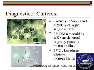 FUNDACION BARCELO FACULTAD DE MEDICINA
Diagnóstico: Cultivos:
 Cultivos en Sabouraud
a 28°C y en Agar
sangre a 37°C.
 28°C:Macroconidias
esféricas de pared
rugosa y gruesa y
microconidias.
 37°C : Levaduras
elípticas
monogemantes.
 