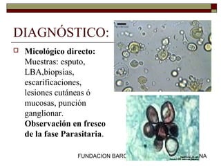 FUNDACION BARCELO FACULTAD DE MEDICINA
DIAGNÓSTICO:
 Micológico directo:
Muestras: esputo,
LBA,biopsias,
escarificaciones,
lesiones cutáneas ó
mucosas, punción
ganglionar.
Observación en fresco
de la fase Parasitaria.
 