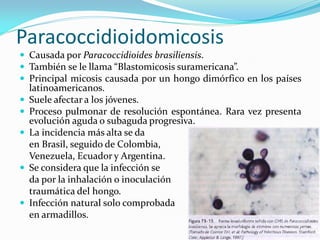 Paracoccidioidomicosis 
Causada por Paracoccidioides brasiliensis. 
También se le llama “Blastomicosis suramericana”. 
Principal micosis causada por un hongo dimórfico en los países latinoamericanos. 
Suele afectar a los jóvenes. 
Proceso pulmonar de resolución espontánea. Rara vez presenta evolución aguda o subaguda progresiva. 
La incidencia más alta se da 
en Brasil, seguido de Colombia, 
Venezuela, Ecuador y Argentina. 
Se considera que la infección se 
da por la inhalación o inoculación 
traumática del hongo. 
Infección natural solo comprobada 
en armadillos.  