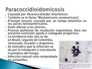  Causada por Paracoccidioides brasiliensis.
 También se le llama “Blastomicosis suramericana”.
 Principal micosis causada por un hongo dimórfico en
los países latinoamericanos.
 Suele afectar a los jóvenes.
 Proceso pulmonar de resolución espontánea. Rara vez
presenta evolución aguda o subaguda progresiva.
 La incidencia más alta se da
en Brasil, seguido de Colombia,
Venezuela, Ecuador y Argentina.
 Se considera que la infección se
da por la inhalación o inoculación
traumática del hongo.
 Infección natural solo comprobada
en armadillos.
 