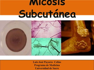 Micosis
Subcutánea



  Luis José Payares Celins
   Programa de Medicina
    Universidad de Sucre
 