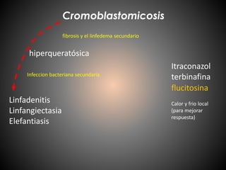 Cromoblastomicosis
hiperqueratósica
Linfadenitis
Linfangiectasia
Elefantiasis
Infeccion bacteriana secundaria
fibrosis y el linfedema secundario
Itraconazol
terbinafina
flucitosina
Calor y frio local
(para mejorar
respuesta)
 