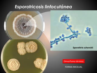 Esporotricosis linfocutánea
Sporothrix schenckii
Dimorfismo térmico
FORMA MICELIAL
 