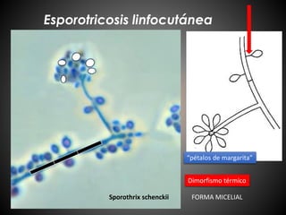 Esporotricosis linfocutánea
Sporothrix schenckii
Dimorfismo térmico
FORMA MICELIAL
“pétalos de margarita”
 