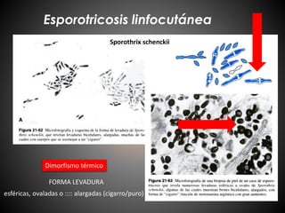 Esporotricosis linfocutánea
Dimorfismo térmico
FORMA LEVADURA
Sporothrix schenckii
esféricas, ovaladas o :::: alargadas (cigarro/puro)
 