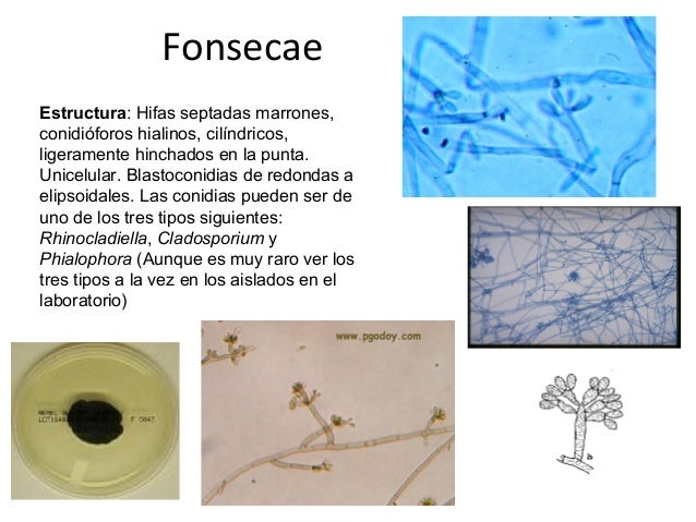 Micosis subcutáneas
