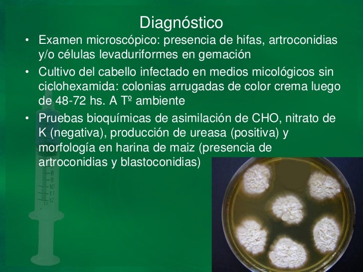 Klotrimazol del hongo de las uñas la solución el precio