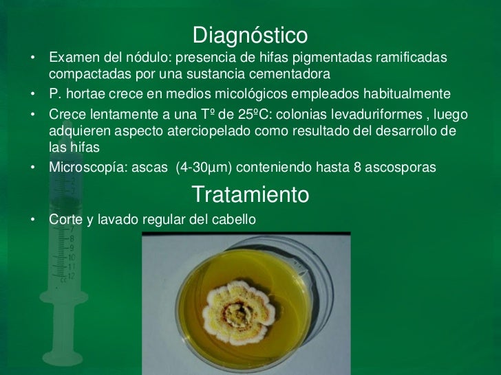 La crema del hongo lotseril
