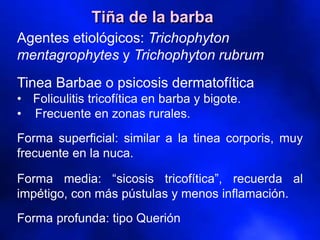 Agentes etiológicos: Trichophyton
mentagrophytes y Trichophyton rubrum
Tinea Barbae o psicosis dermatofítica
• Foliculitis tricofítica en barba y bigote.
• Frecuente en zonas rurales.
Forma superficial: similar a la tinea corporis, muy
frecuente en la nuca.
Forma media: “sicosis tricofítica”, recuerda al
impétigo, con más pústulas y menos inflamación.
Forma profunda: tipo Querión
Tiña de la barba
 