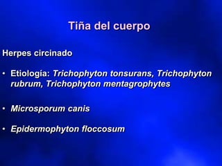 Tiña del cuerpo
Herpes circinado
• Etiología: Trichophyton tonsurans, Trichophyton
rubrum, Trichophyton mentagrophytes
• Microsporum canis
• Epidermophyton floccosum
 