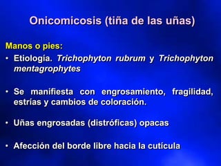 Onicomicosis (tiña de las uñas)
Manos o pies:
• Etiología. Trichophyton rubrum y Trichophyton
mentagrophytes
• Se manifiesta con engrosamiento, fragilidad,
estrías y cambios de coloración.
• Uñas engrosadas (distróficas) opacas
• Afección del borde libre hacia la cutícula
 