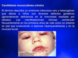 Candidiasis mucocutánea crónica
El término describe un síndrome infeccioso raro y heterogéneo
que afecta a niños con diversos defectos genéticos
(generalmente deficiencia en la inmunidad mediada por
células). Las manifestaciones clínicas comienzan
frecuentemente en los primeros años de vida como un eritema
en piel que evolucionan a lesiones hiperqueratósicas y en la
mucosa bucal.
 