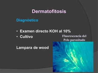Dermatofitosis
Diagnóstico
• Examen directo KOH al 10%
• Cultivo
Lampara de wood
Fluorescencia del
Pelo parasitado
 