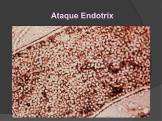 Ataque Endotrix
 